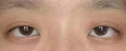 脑子笨十大特征,智障的十大表现?